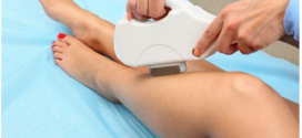 Factors which Impact the Outcome of Laser Hair Removal Procedure