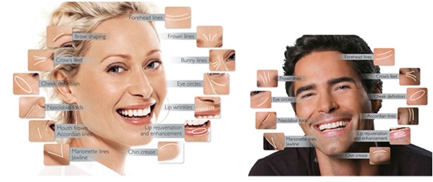Hyaluronic acid Filler For Facial Treatment